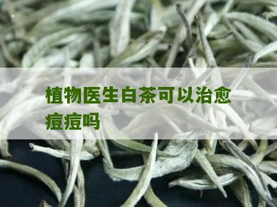 植物医生白茶可以治愈痘痘吗