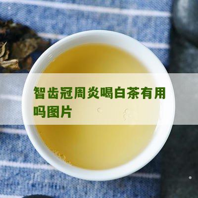 智齿冠周炎喝白茶有用吗图片